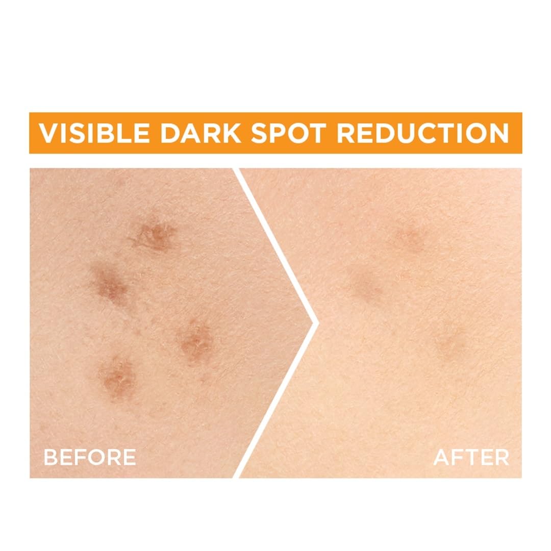 Garnier Skin Naturals - Face Serum 30ml