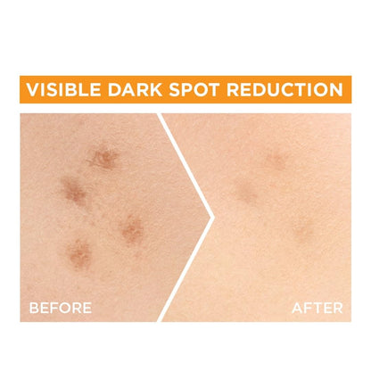 Garnier Skin Naturals - Face Serum 30ml