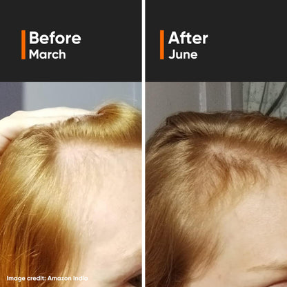 Minimalist Hair Growth Serum