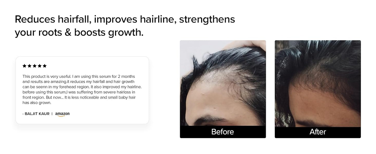 Minimalist Hair Growth Serum